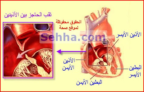 القسطرة القلبية CC10