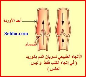 أمراض القلب و الجهاز الدوري Cardiovascular diseases DVT05