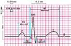 أمراض القلب و الجهاز الدوري Cardiovascular diseases HF3