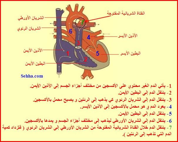 القناة الشريانية المفتوحة Patent Ductus Arteriosus - PDA PDA3