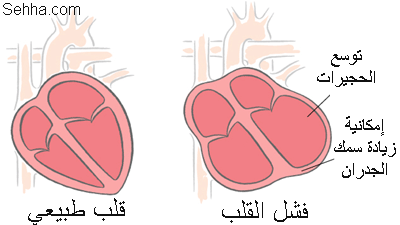 أمراض القلب و الجهاز الدوري Cardiovascular diseases Heart_art