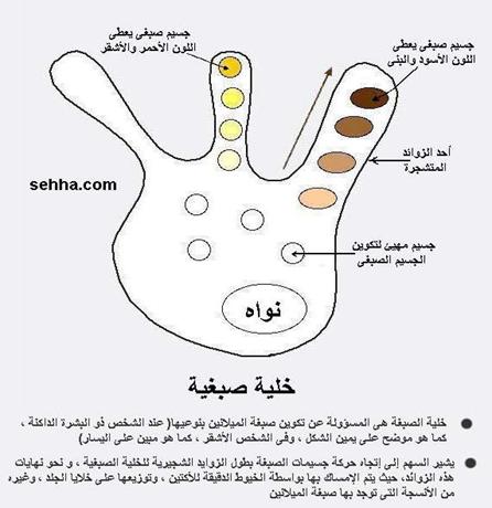 الأمراض الوراثية Genetic Disorders Albinism04