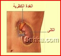 أمراض الغدد الصم Endocrine disorders Aldosteronism01