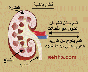 اعتلال الكلى السكري Diabetic nephropathy Diabetic_nephropathy4