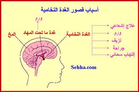 الغدة النخامية Pituitary Gland Hypopituitarism04