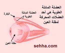 أمراض العيون Eye diseases Brown_Syndrome2