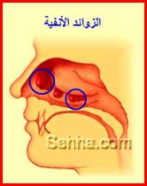 القطرة والصيام TDO08