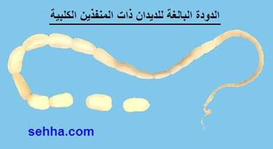 الديدان الشريطية -Tapeworms  Tapeworms2