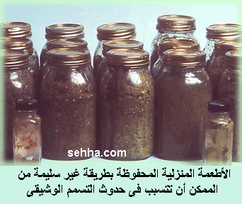 التسمم الوشيقي Botulism Botulism12