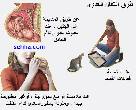 ماذاتعرف عن داء القطط Toxoplasmosis11