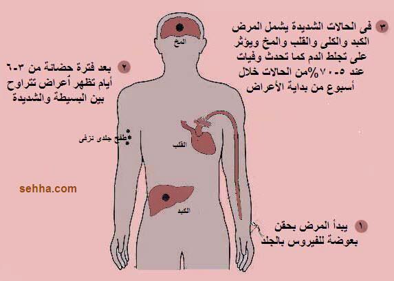 الحمى الصفراء Yellow Fever Yellow-Fever08