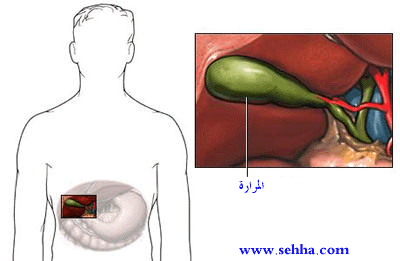  أمراض والتهابات المرارة Gall bladder  Gallbladder3