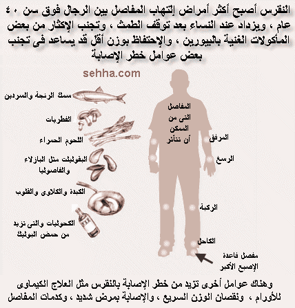 مرض الملوك أو النقرس واعراضه واسبابه والوقاية منه Gout01