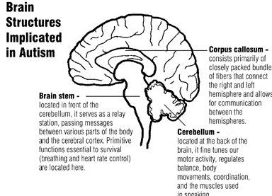 مرض التوحد Autism Autism1