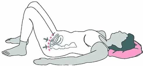 تمرينات لعلاج سلس البول Incontinence3