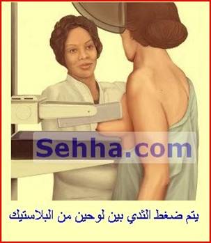  ما هي أشعة الماموجرام؟ Mammography4