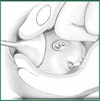 الحمل والولادة Pregnancy & Delivery As-delivery2