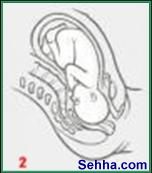 أوضاع الجنين عند الولادة Fetal presentations during labor Occiptant