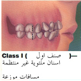 ملف كامل عن طب الأسنان بالصور CL1
