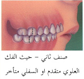 ملف كامل عن طب الاسنان بالصور CL2