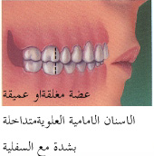 ملف كامل عن طب الاسنان بالصور Deepbite