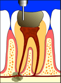 ملف كامل عن طب الاسنان بالصور Rc1