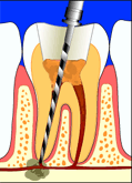 ملف كامل عن طب الاسنان  Rc2