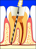 ملف كامل عن طب الاسنان بالصور Rc3