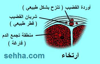 اقوى علاج بالاعشاب للضعف الجنسى وسرعه القذف للرجال فقط EDCF1