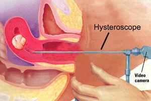 الجراحة والمناظير موضوع شامل +بالصور +شرح كل اجهزة المناظير HSC