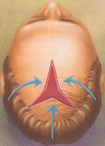 جراحات التجميل والإصلاح Plastic surgeries Hairtransp4