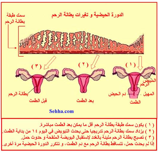ما هو داء بطانة الرحم الهاجرة؟ What is endometriosis  Endometriosis7