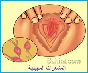 الالتهابات المهبلية Vaginitis6