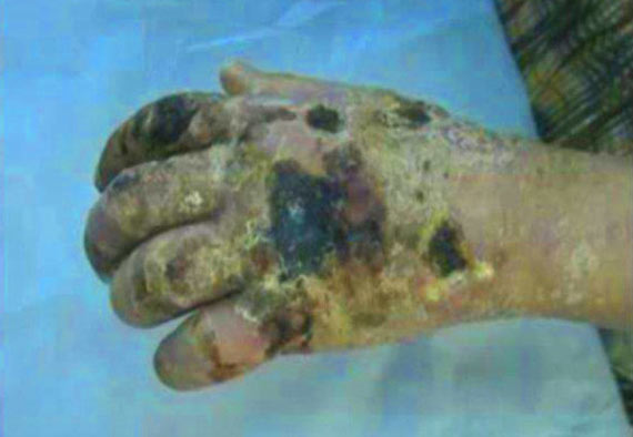 Krokodil, la nueva heroína Cocodrilo5