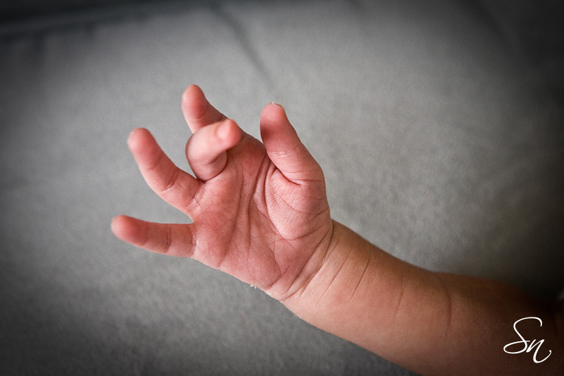 Why do physicians check the palmar lines of newborn babies? Newborn_baby_hand