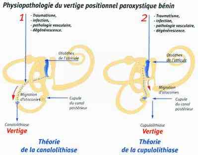 Vertige Vertige2-399x312