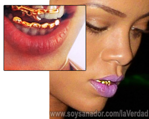 ¿Oro monoatómico = Oro de la alquimia = increíble longevidad? (Actualizado) Rihanna-dientes-de-oro