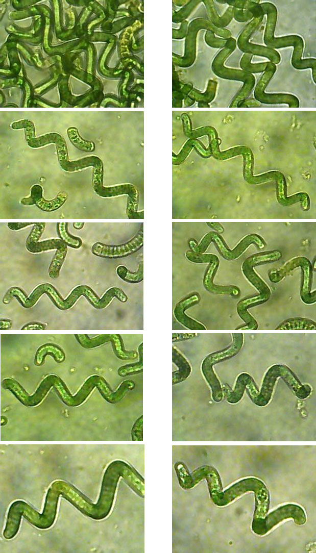 La spiruline  Production-spiruline-microscope