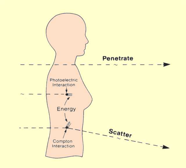 Gamma interaction with matter 10INTERACT01