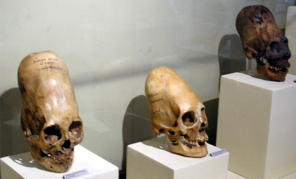 DNA Analysis Of Paracas Elongated Skulls Released. The Results Prove They Were Not Human 9rzaq-elongated2