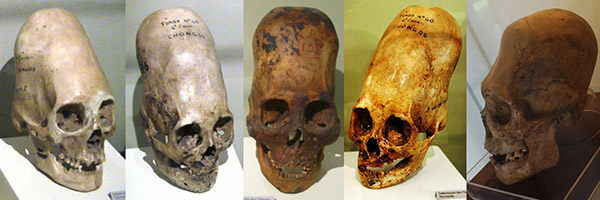 DNA Analysis Of Paracas Elongated Skulls Released. The Results Prove They Were Not Human Ulta8-elongated