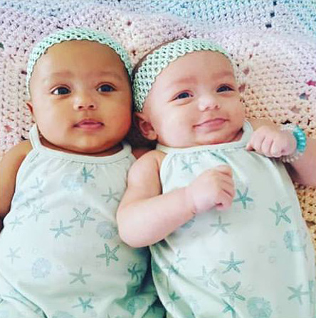 These 'Miracle' Twin Baby Girls Were Born With Different Skin Colors  0eyrk-twins-different-color-skin-05