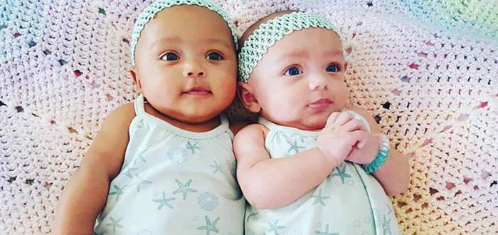 These 'Miracle' Twin Baby Girls Were Born With Different Skin Colors  Dnrdq-twins-different-color-skin-09