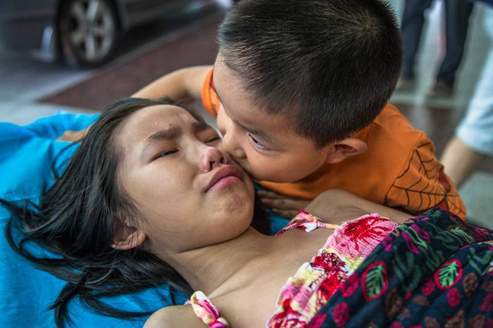 Heartwarming Photos Of A Young Boy Comforting His Older Sister At The Hospital  D2a60-little-brother-cares-for-sister-in-pain-3