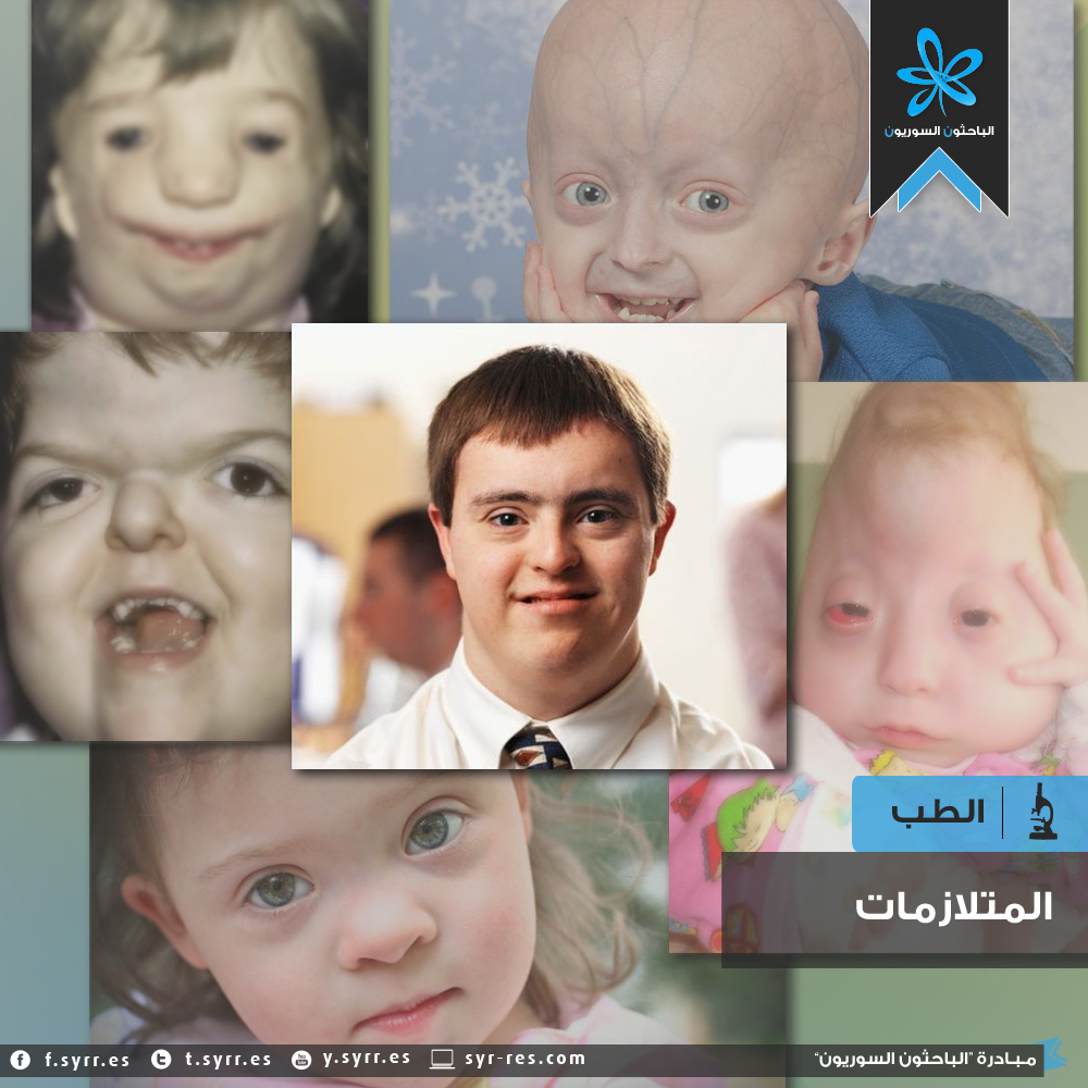 ماهي المتلازمة syndrome ؟ 43644066