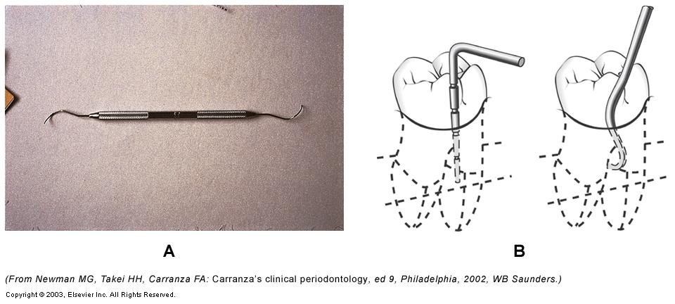 Chronic Periodontitis  2469