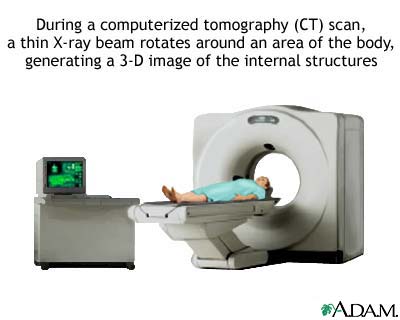 موسوعة أمراض القولون والمستقيم والشرج Ct-scan