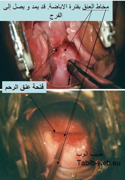 موضوع متكامل عن..متى يحدث الحمل..تشخيص Glaire_vulve