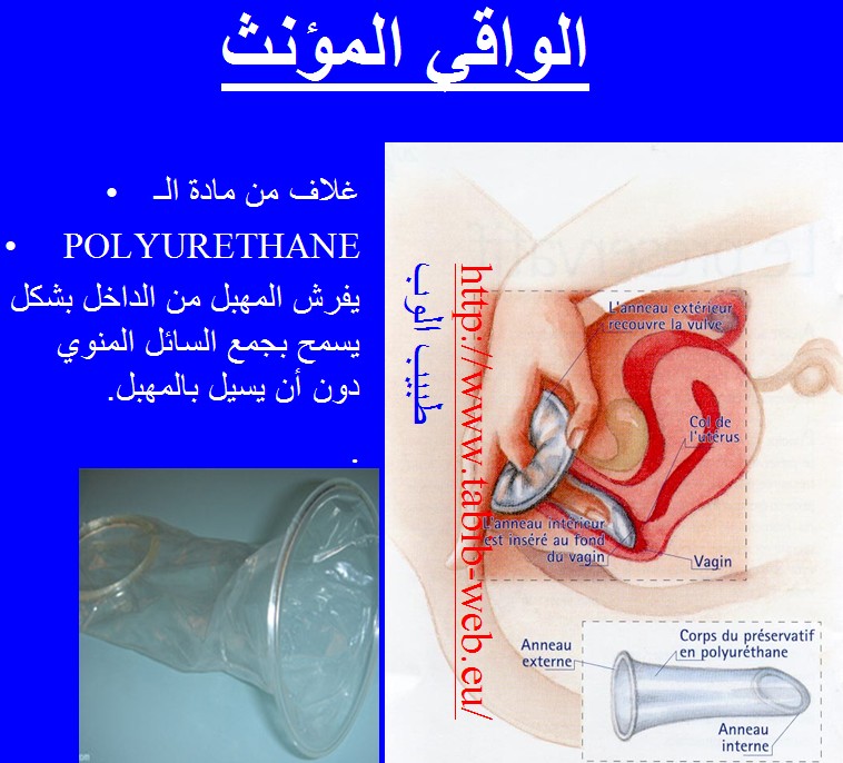 طرق و اساليب منع الحمل  Contraception_2