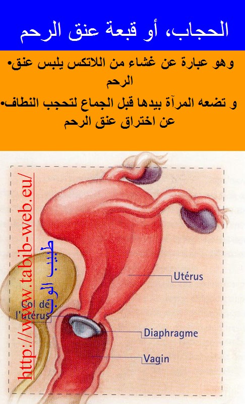 طرق و اساليب منع الحمل  Contraception_5